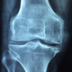 Illustration for article titled The Advantages of Knee Support Devices for Obese Men and Women